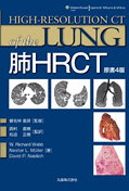 HRCT